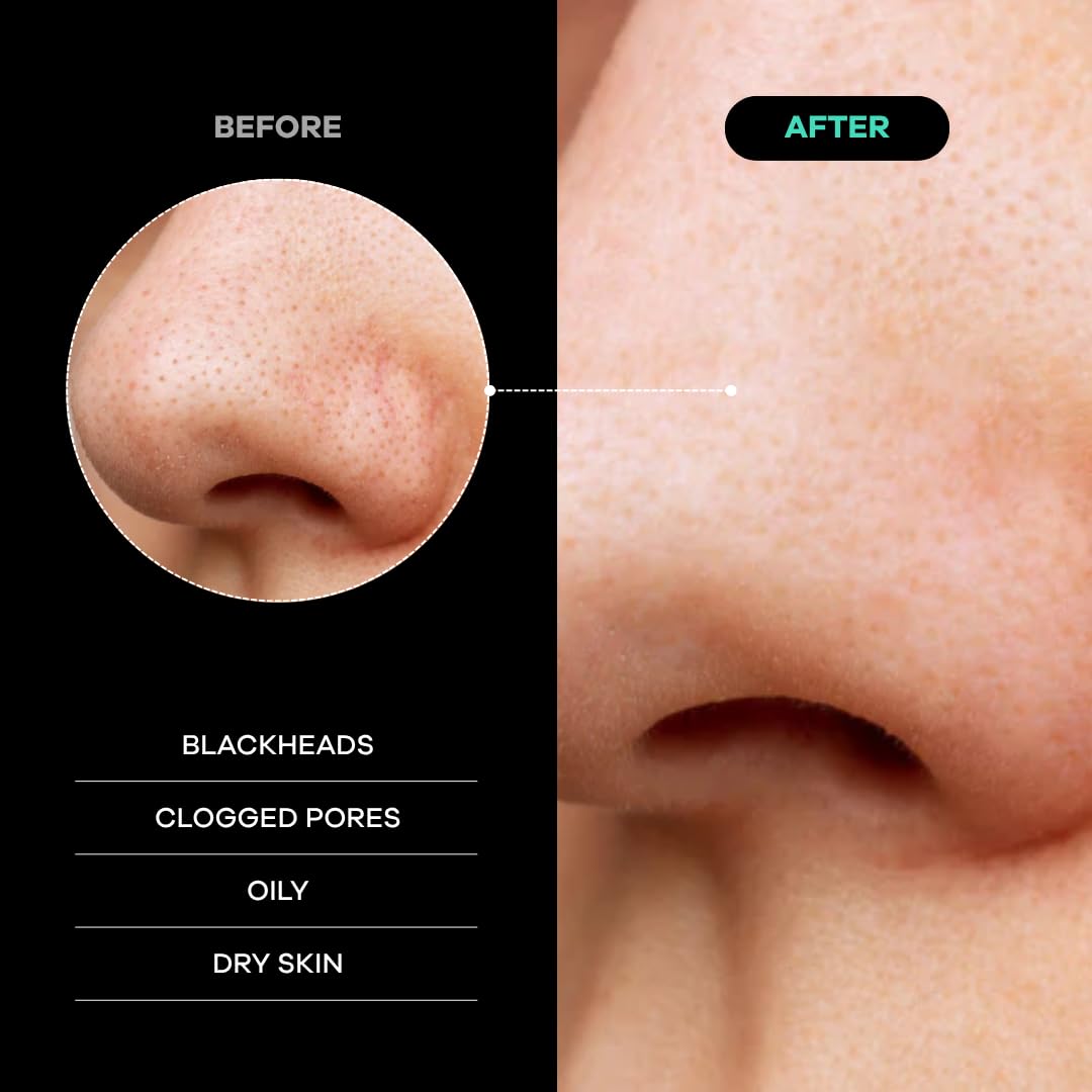 Dermasuri Deep Exfoliating Face Mitt - Scrubber, Dead and Dry Skin Remover for Men and Women - Exfoliator Gloves for Shower and Dry Use - (2 Pack)