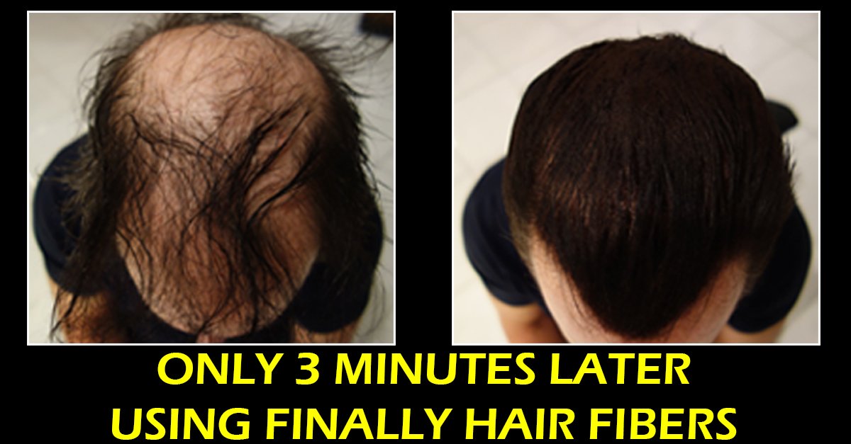 Keratin Hair Building Fibers. 28g Finally Hair Building Fibers Bottle & Finally Hair 120ml 4.1 Oz. Fiber Lock Hair Loss Concealer Spray. (Light Salt & Pepper - Special Light Brown Grey Mix)