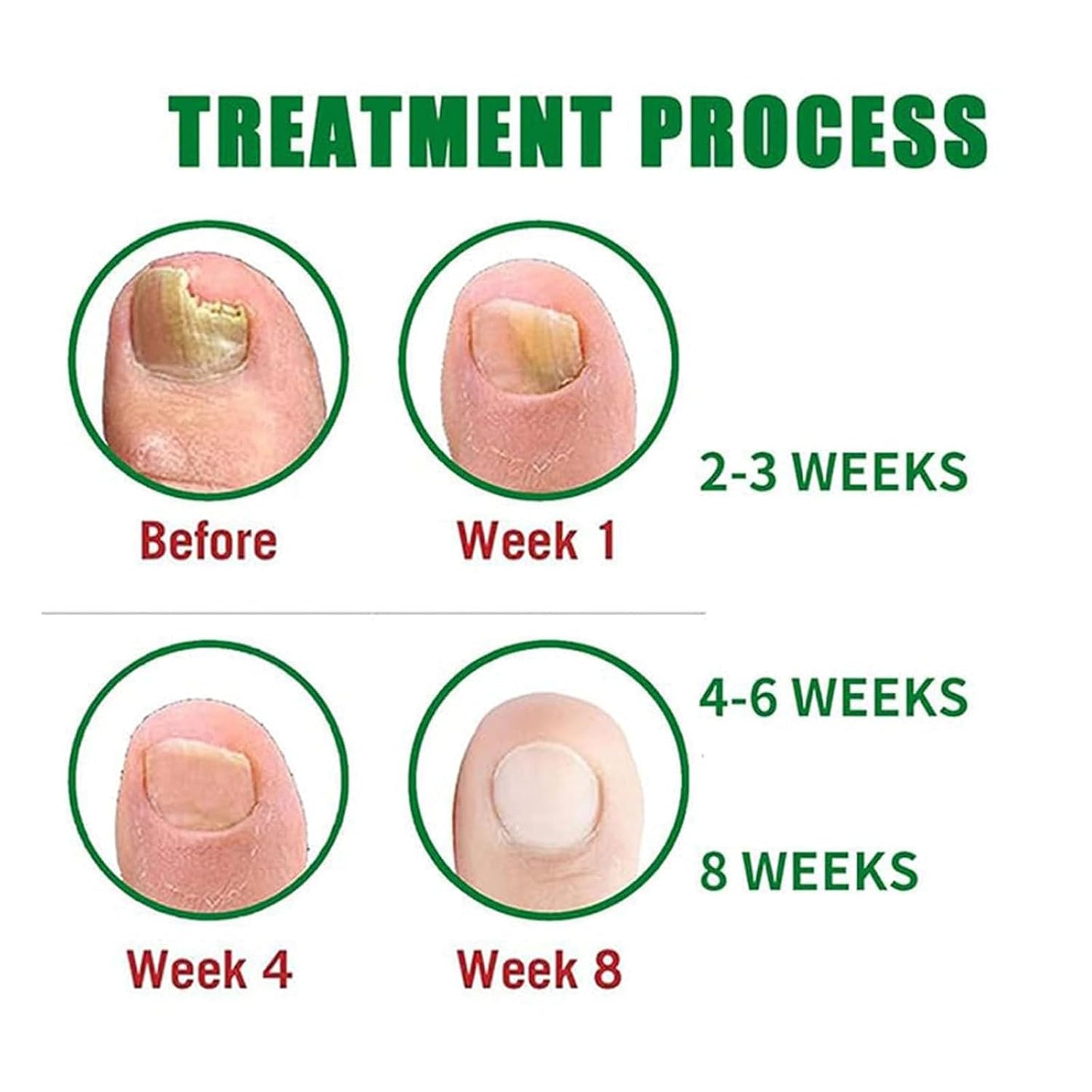 Nutraboost Nail Treatment, Nail Growth Serum for Repair & Strengthener,Multi-Purpose Nail Repair Oil Serum (2)