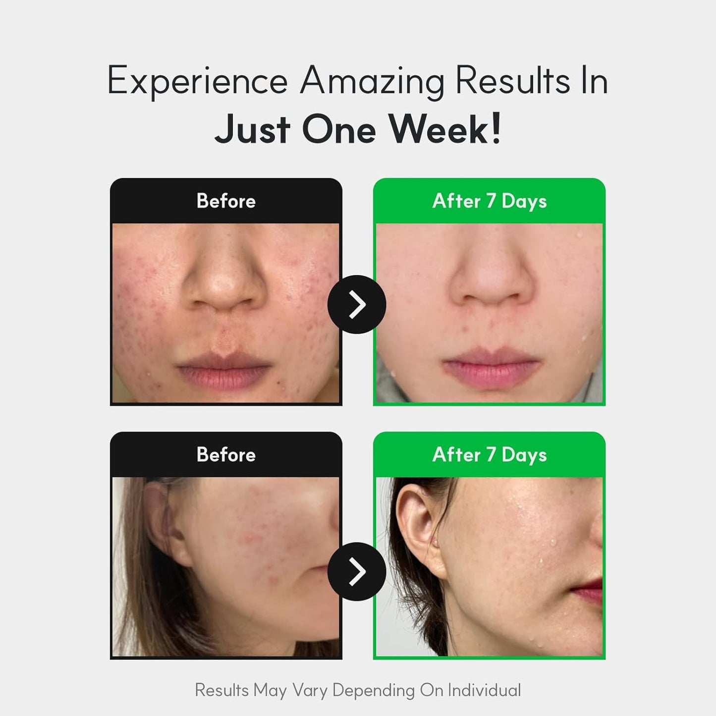 Centelsome 5X Soothing Toner 6.76 fl oz/200ml | Hydrating & Calming Korean Facial Toner with Green Tea, Centella Asiatica & Exosomes | Supports Sensitive, Dry & Acne-Prone Skin