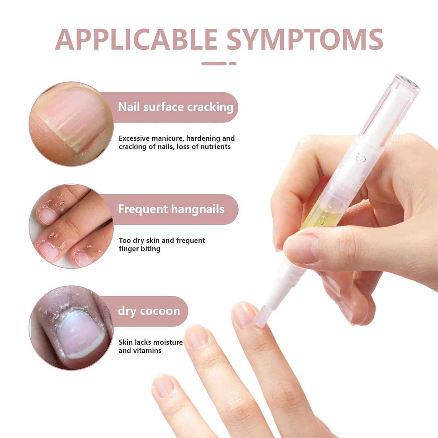 Rejuvenation Nail Growth Pen,Radiant Nail Growth & Strengthening Oil Pen with Cuticle Care and Manicure Nourishment for Moisturizing Nail Care,2Pcs