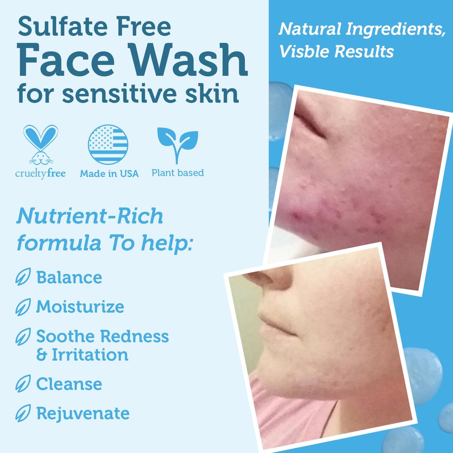 Era Organics Manuka Honey Face Wash for Women, Men - Sulfate Free Moisturizing Cleanser, Organic Aloe Vera - Soothing Plus Gentle on Dry Skin Facial Cleanser Made in USA - 8oz