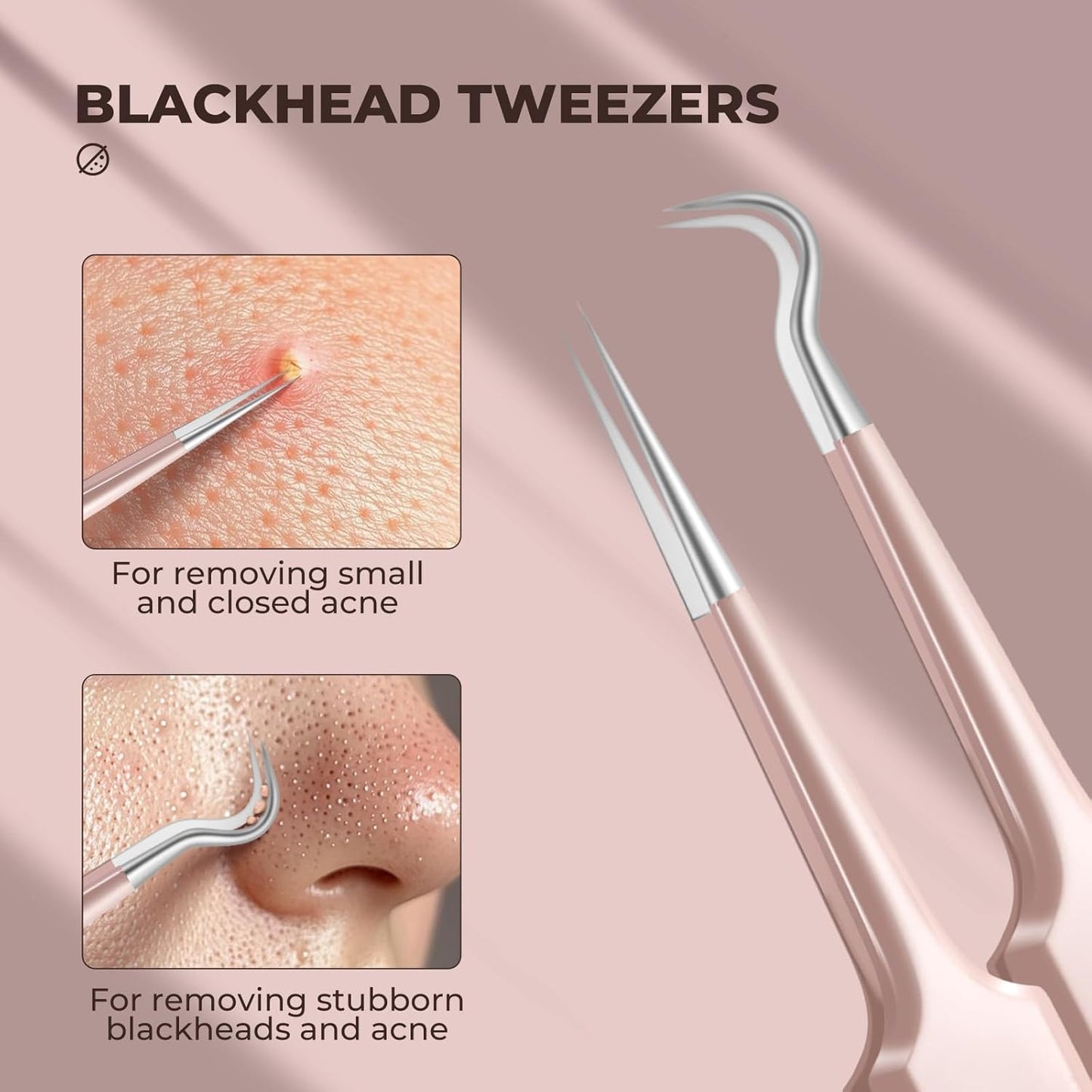 Professional Blackhead Tweezers, Stainless Steel Blackhead Remover Tools, Pimple Popper Tool Kit for Acne Whitehead Blemish, Pore Prep Tool