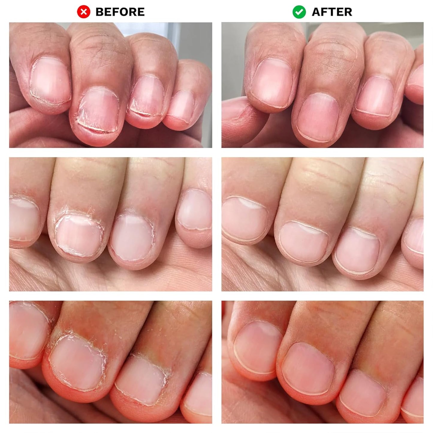 Nails Spray, New Tea Oil Extra-Strength Toenail Treatment, 7 Days Nail Treatment | Keeps Feet Fresh & Dry All Day | Men & Women (1 PCS)