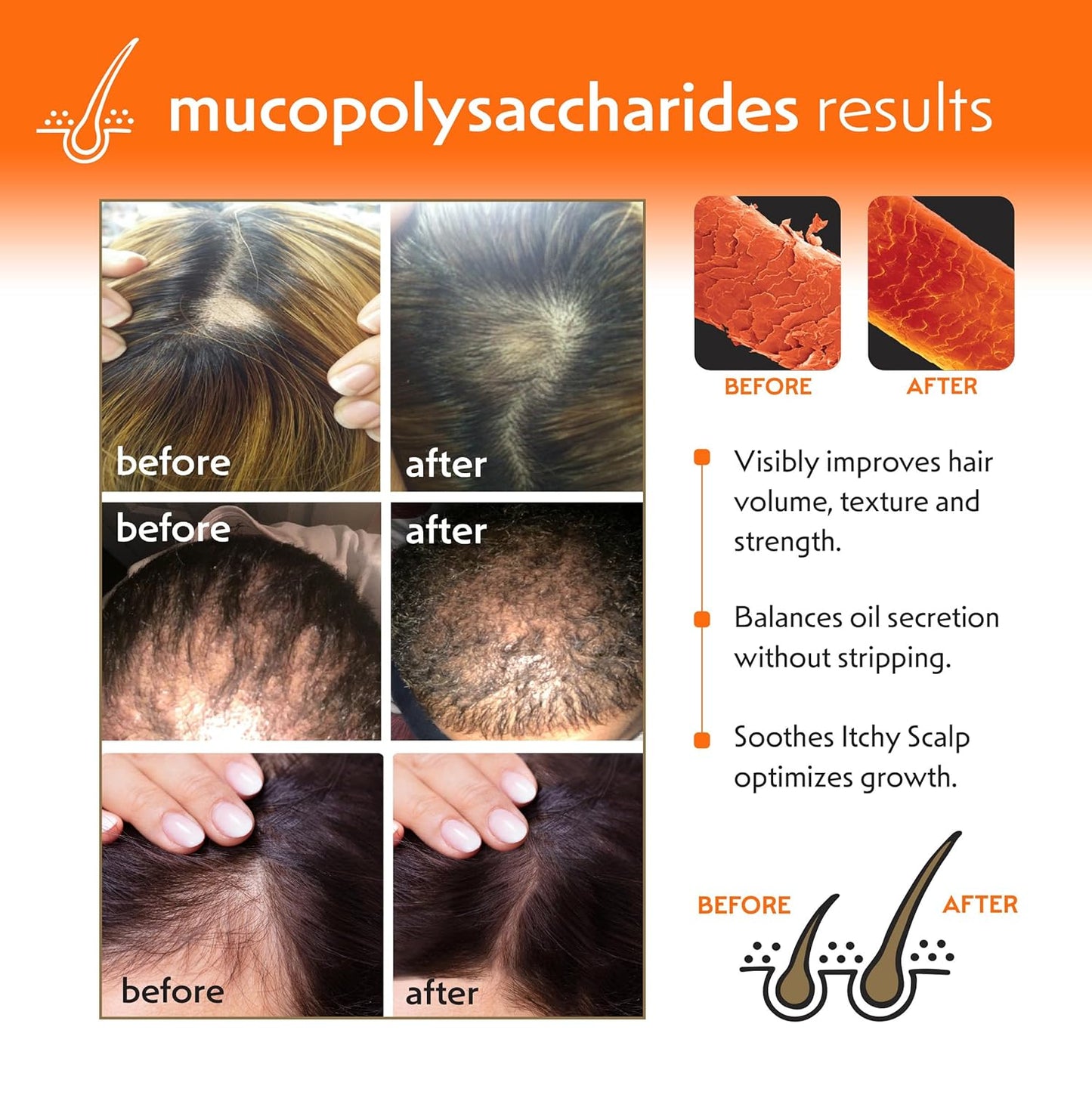 Regrowth Hair & Scalp Revitalizer Leave-In Spray, Biotin & Tea-Tree Oil, Restores Hair Loss, Promotes Hair Growth, Heat Protectant, 8 oz