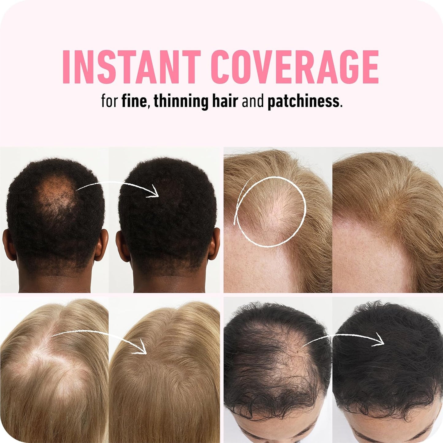 BOLDIFY Hair Fibers (56g) - Fill In Thinning and Fine Hair for an Instantly Fuller, Thicker Look - 14 Shades for Women & Men - White