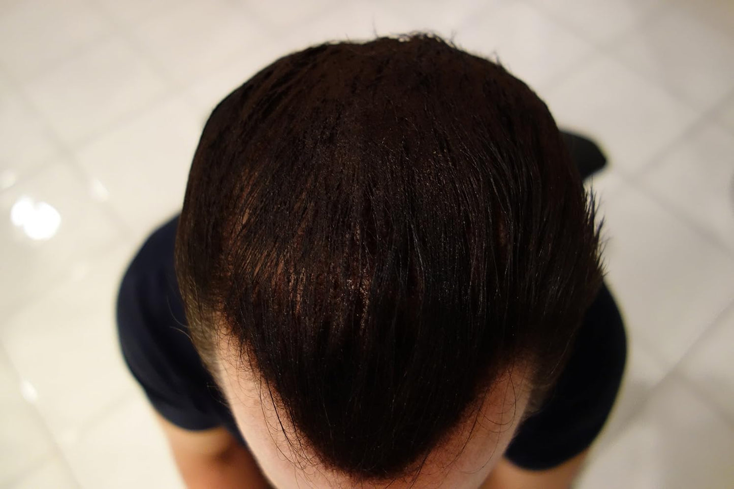 Finally Hair Hair Fiber Refill 100 Grams For Hair Loss Concealing by Finally Hair (White)