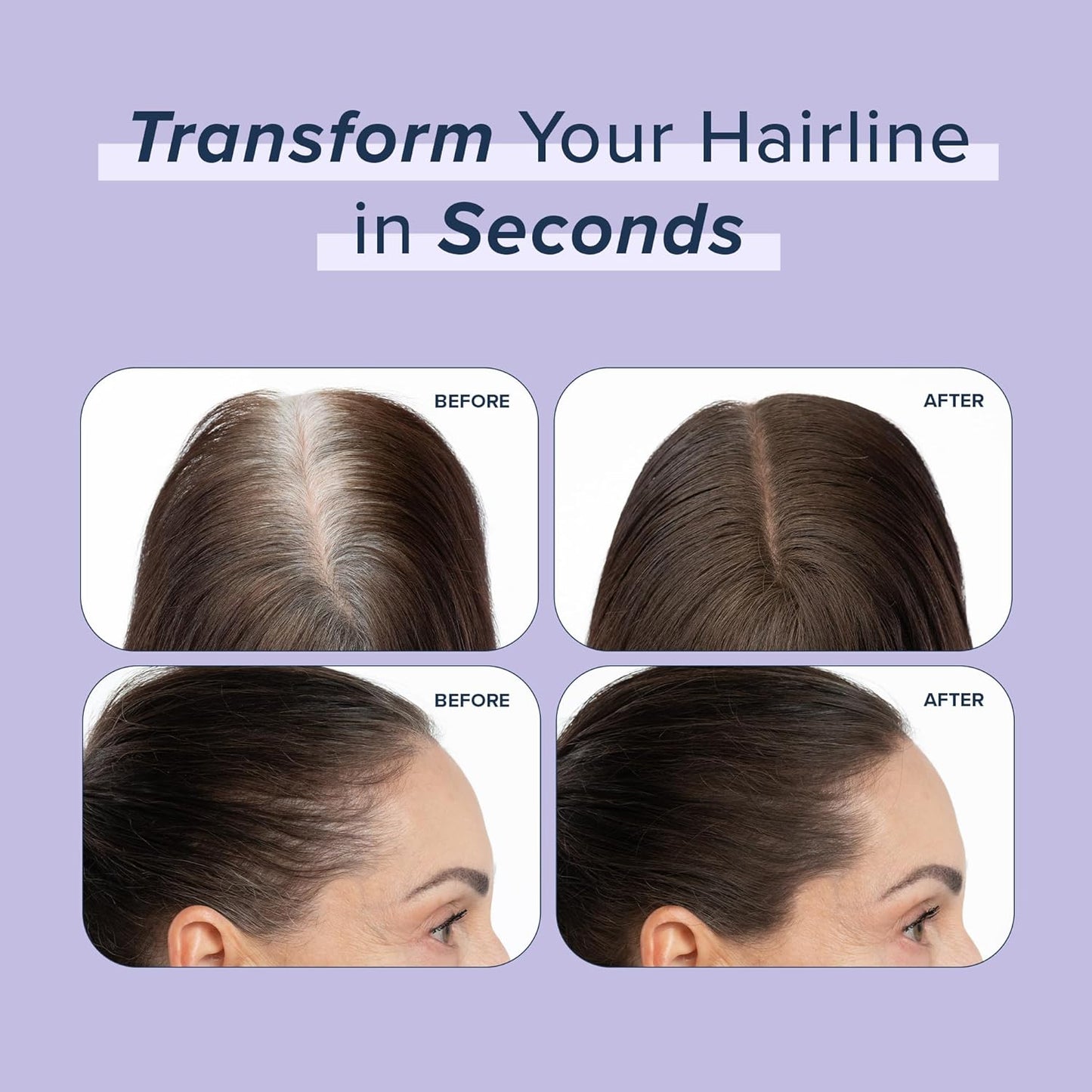 TRUHAIR Root & Scalp Cover Up Pressed Powder Compact, Waterproof, Weightless Hair Coverage & Bald Spot Concealing, Root Touch Up Hair Color for Gray Coverage & Thinning Areas, 0.35 Oz (Auburn)