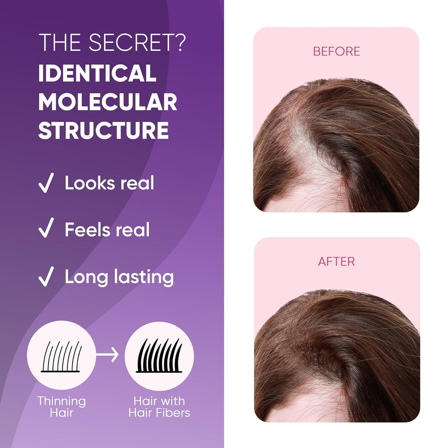 GBG Hair Fibers for Thinning Hair & Bald Spots (Grey) - 25g Bottle - Conceals Hair Loss - Instant Cover Up & Volume in 30 Seconds, Hair Powder for Women & Men - Cruelty Free