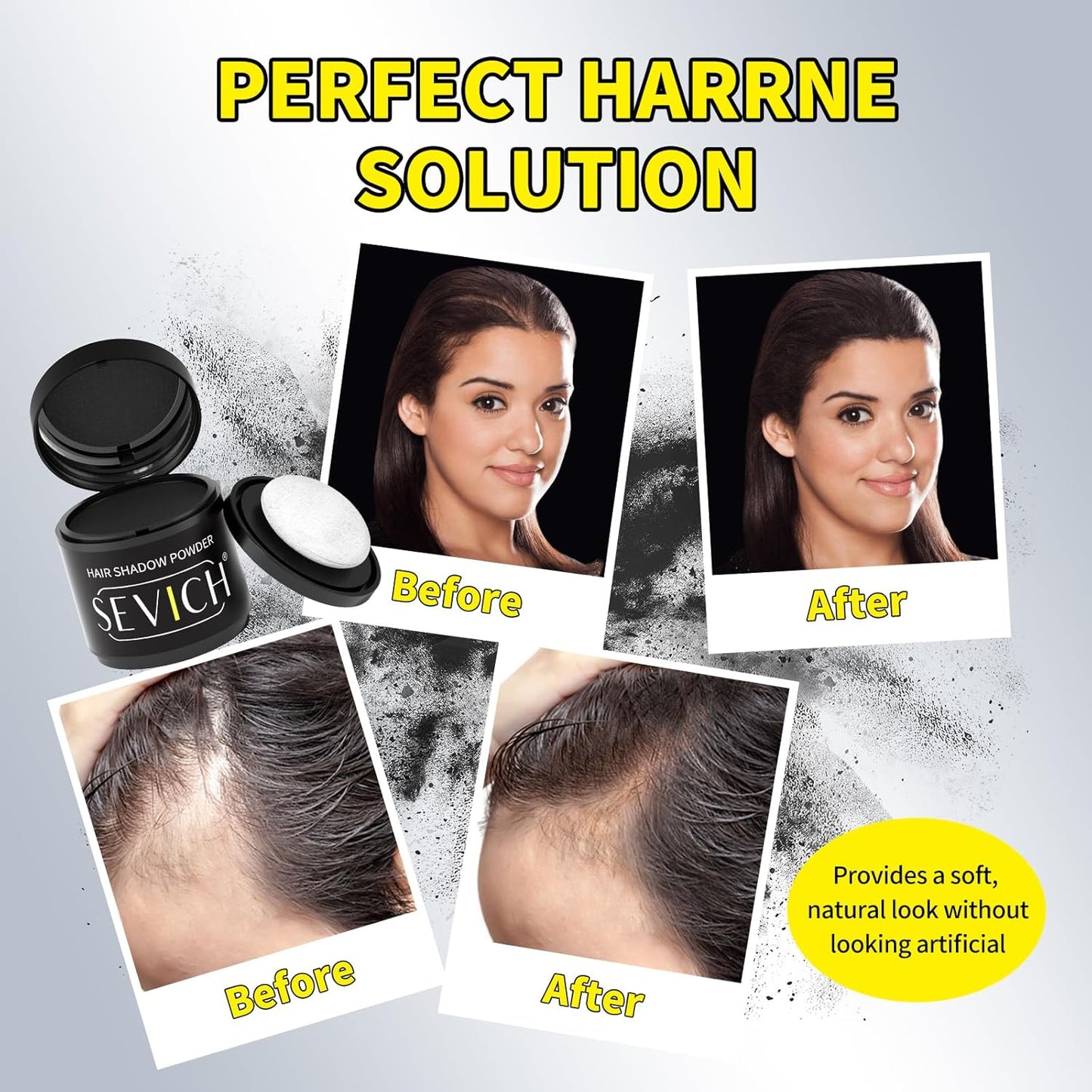 Sevich Hairline Powder 10g Large Capacity - Instantly Conceals Hair Loss, Root Touch up, Shadow Toppers for Women & Men Thinning Gray Hair - 48H Makeup Lasting, 1 Box = 2.5 Boxes, Dark Brown